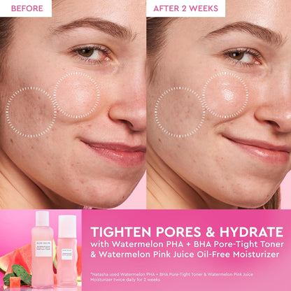 Pink Juice Water Gel Face Moisturizer for Women, Men & Teens - Hydrating Hyaluronic Acid, Radiance Boosting, Non-Comedogenic, Oil-Free, Long-Lasting Korean Skin Care for Oily Skin (50Ml)